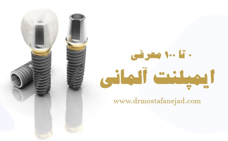 ایمپلنت آلمانی