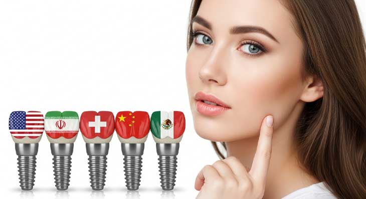 بهترین برند های ایمپلنت دندان