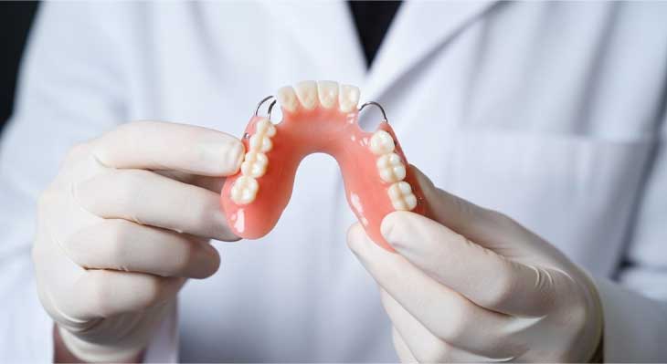 پروتز متحرک